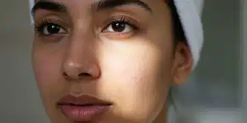 Pele limpa e radiante após rotina de skincare para acne